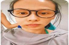 脸部变形的疾病